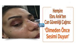 Hemşire Ebru Anik’ten Can Güvenliği Çağrısı: 'Ölmeden Önce Sesimi Duyun'