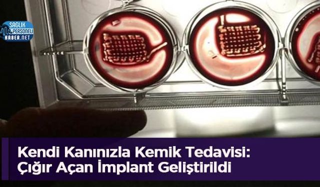 Kendi Kanınızla Kemik Tedavisi: Çığır Açan İmplant Geliştirildi