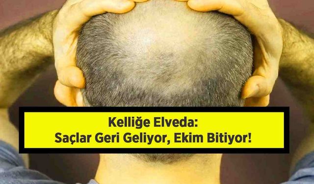 Kelliğe Elveda: Saçlar Geri Geliyor, Ekim Bitiyor!