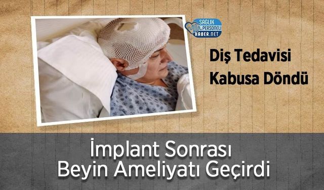 Diş Tedavisi Kabusa Döndü: İmplant Sonrası Beyin Ameliyatı Geçirdi