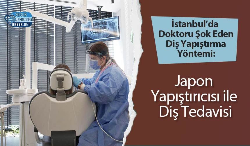 İstanbul’da Doktoru Şok Eden Diş Yapıştırma Yöntemi: Japon Yapıştırıcısı ile Diş Tedavisi