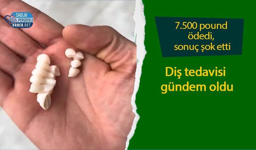7.500 pound ödedi, sonuç şok etti:  Diş tedavisi gündem oldu