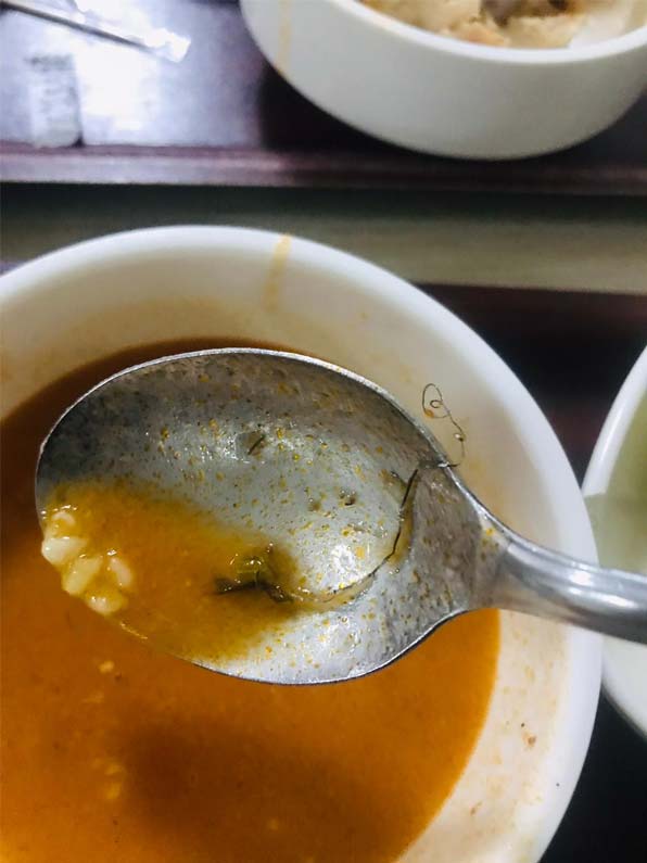 Karabuk Hastanesi Yemek 1